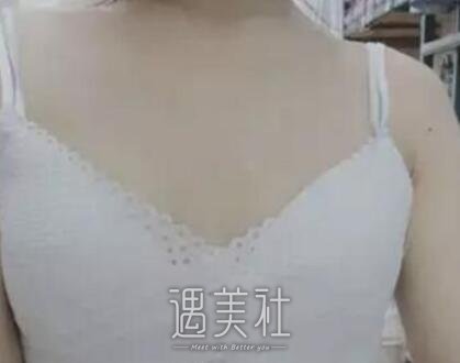 曾昂,丰胸
