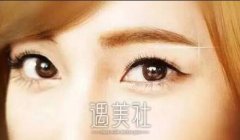 美杜莎眼眼部手术与帕克美眼那个好? width=