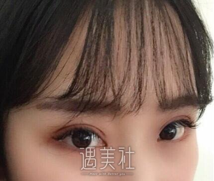 上海,九院,苏薇洁,双眼皮