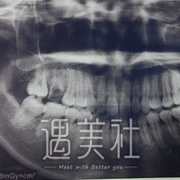 济南华侨医院王光秀美容冠技术如何?真实案例一览~