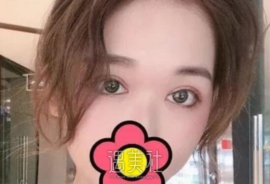 兰州时光整形医院怎么样?2020崭新案例及价格表一览~