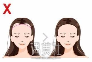 增发纤维