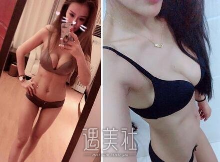 南昌,甘海平,丰胸