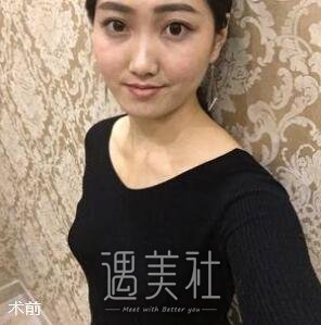 北京,英煌,赵敏,丰胸