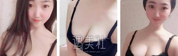 北京,英煌,赵敏,丰胸