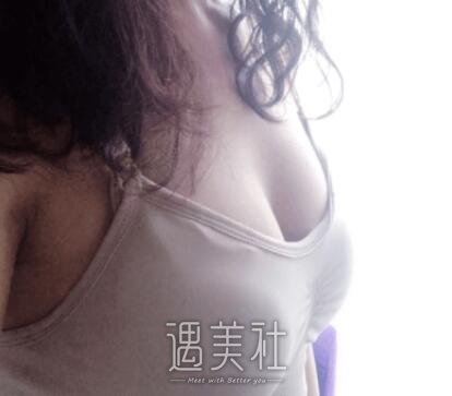李朕,丰胸