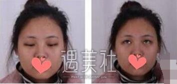 杜园园,双眼皮