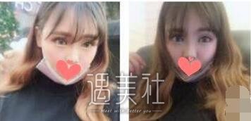 杜园园,双眼皮