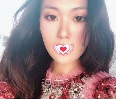 苏薇洁,双眼皮