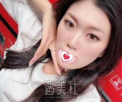 苏薇洁,双眼皮