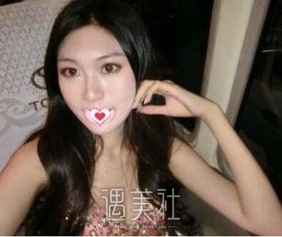苏薇洁,双眼皮