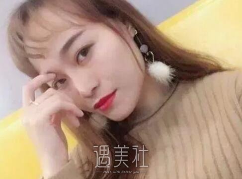 李青峰,隆鼻