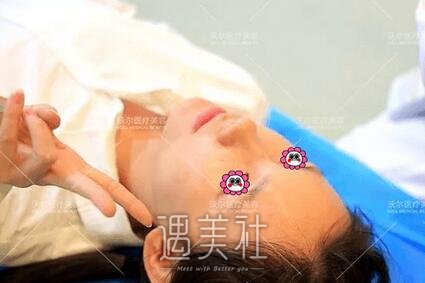 刘彦军,隆鼻