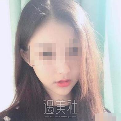 上海首尔丽格做下颌角怎么样?在线案例一览~