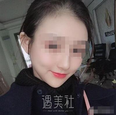 上海首尔丽格做下颌角怎么样?在线案例一览~