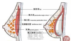 假体隆胸失败的原因是什么？手术风险大吗？ width=