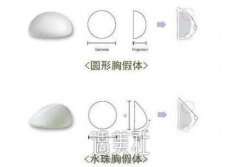 南京隆胸价格贵吗？价格和什么有关？ width=