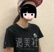八大处栾杰丰胸案例：胸部饱满才是真的魅力无极限！ width=
