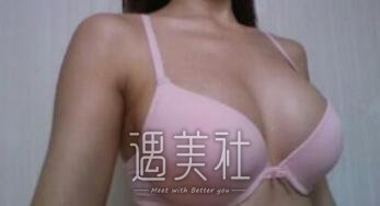 朱欣欣,丰胸
