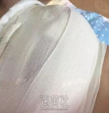 上海,九院,王涛,假体丰胸