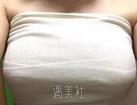 上海,九院,王涛,假体丰胸