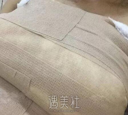 上海,九院,王涛,假体丰胸