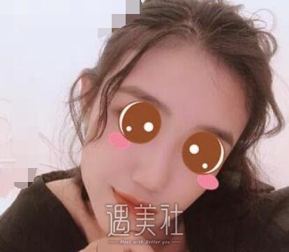 北京,王军,隆鼻