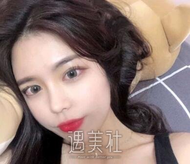 黄金龙,隆鼻