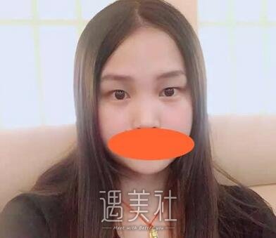 王国明,双眼皮