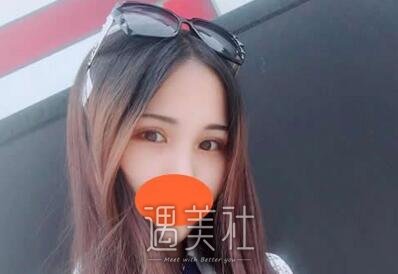 王国明,双眼皮