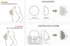 假体隆胸会不会影响乳房的敏感？怎么样让胸部变大？ width=