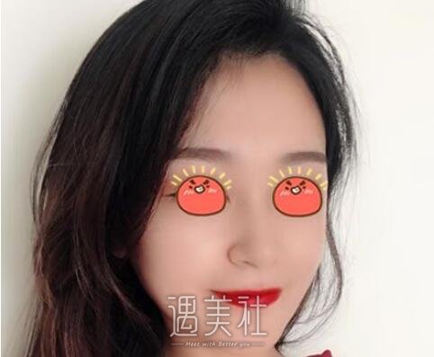 李斌斌,隆鼻