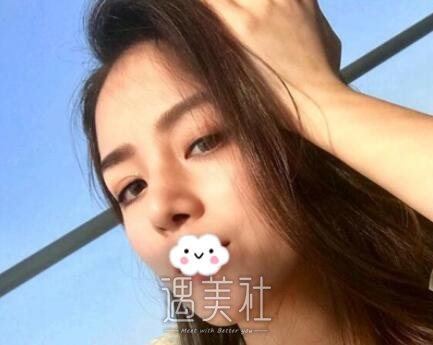 李庭勋,隆鼻