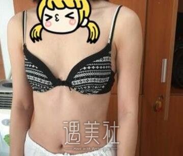 栗勇,丰胸