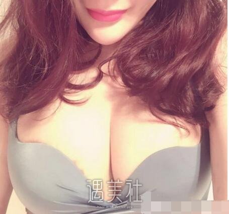 刘成胜,脂肪丰胸