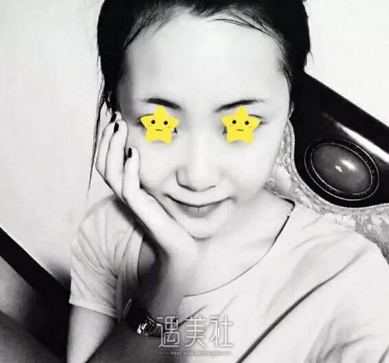 王珍祥做鼻子怎么样|王珍祥隆鼻案例硬核证明!