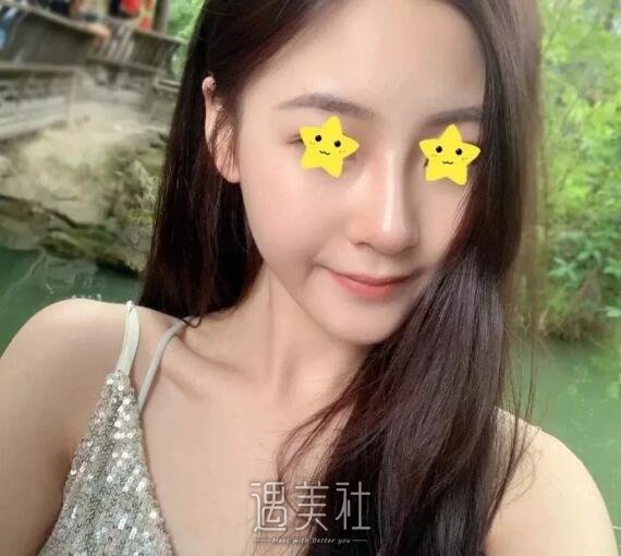 王珍祥做鼻子怎么样|王珍祥隆鼻案例硬核证明!
