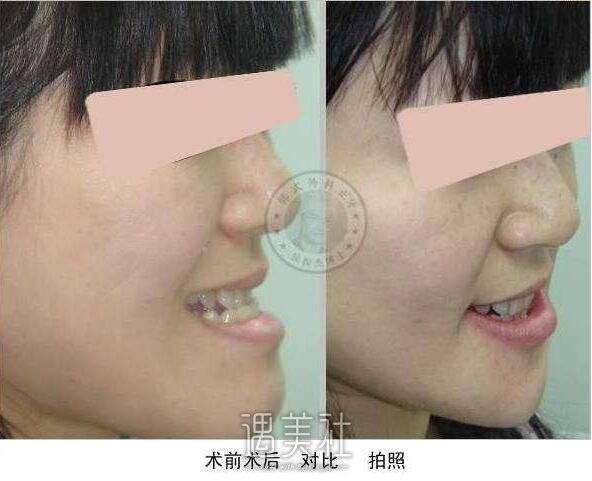 四医大口腔医院价格表2020更新啦，项目很多方面~
