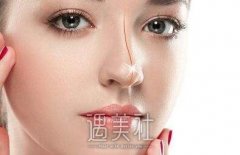 假体隆鼻手术会不会有什么危害？怎样预防术后并发症？ width=
