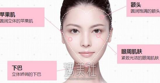 东莞,面部凹陷填充