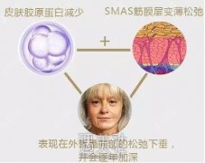 韩国清潭fist成镇模纵深肌理归位术，解决面部衰老果持久~ width=