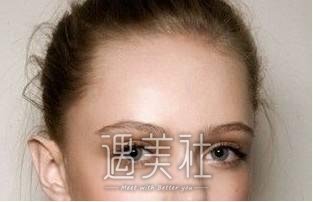 脂肪填充额头太高了怎么办?能改良吗?