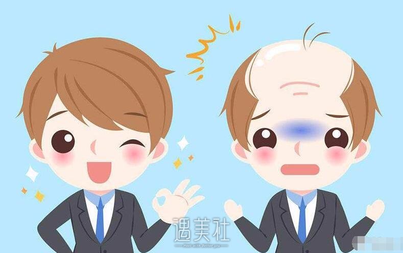 自体毛发移植能存活吗?成活率一般是多少?