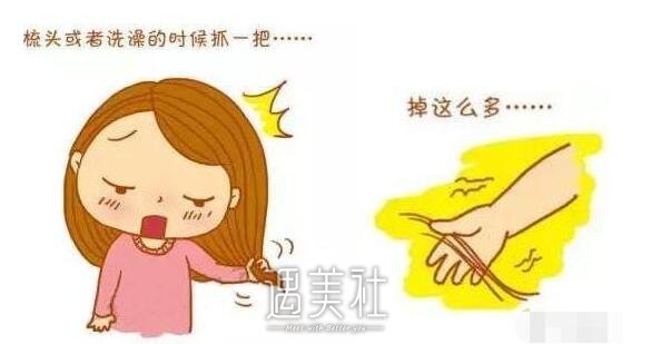 自体毛发移植能存活吗?成活率一般是多少?