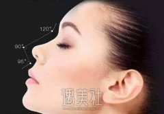 南京假体隆鼻失败修复多少钱？术后失败怎么办？ width=