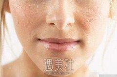 假体隆鼻后会不会显得僵硬?术后多久可以恢复自然? width=