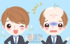 杭州自体毛发移植术价格大约多少钱？想知道~ width=