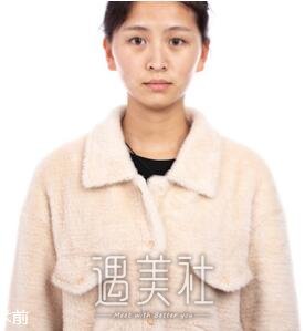 广州,曙光,双眼皮