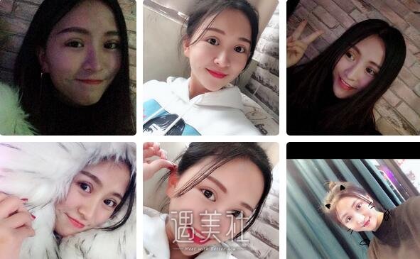广州,曙光,双眼皮