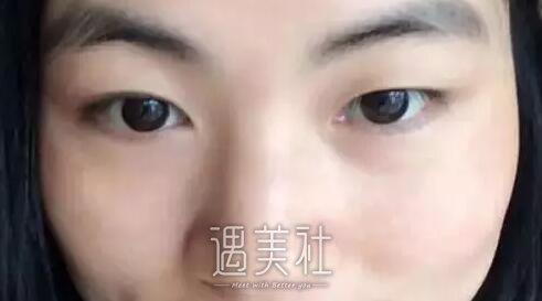 南充阿蓝整形医院祛斑怎么样?真实案例一览~